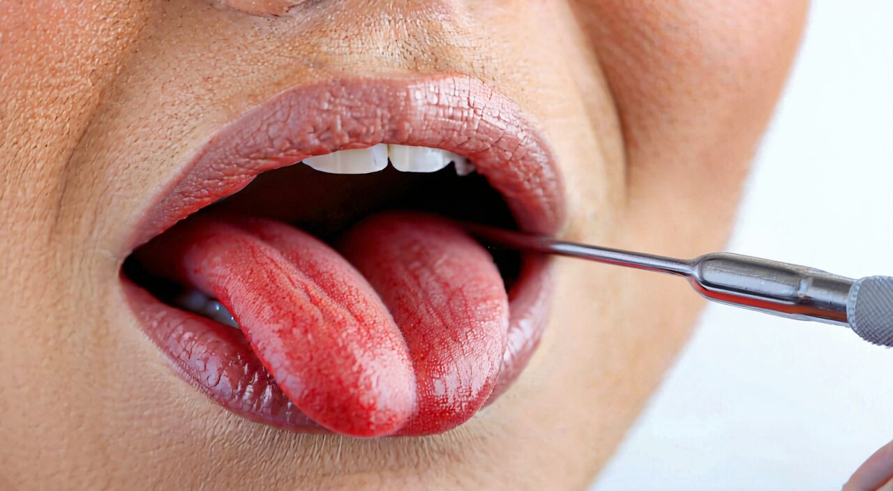 Examining red and swollen throat, indicating heat-toxin sore throat